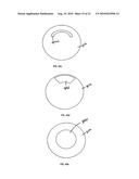 METHOD FOR LASER CORRECTION OF REFRACTIVE ERRORS OF AN EYE WITH A THIN CORNEA diagram and image