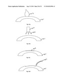 METHOD FOR LASER CORRECTION OF REFRACTIVE ERRORS OF AN EYE WITH A THIN CORNEA diagram and image