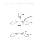 METHOD FOR LASER CORRECTION OF REFRACTIVE ERRORS OF AN EYE WITH A THIN CORNEA diagram and image