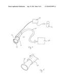 METHODS AND DEVICES FOR REMOVING OMENTAL TISSUE diagram and image