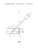 Method and system for sealing percutaneous punctures diagram and image