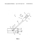 Method and system for sealing percutaneous punctures diagram and image