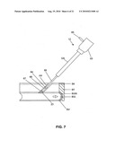 Method and system for sealing percutaneous punctures diagram and image