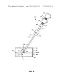 Method and system for sealing percutaneous punctures diagram and image