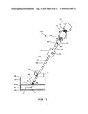 Method and system for sealing percutaneous punctures diagram and image