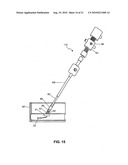 Method and system for sealing percutaneous punctures diagram and image