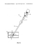 Method and system for sealing percutaneous punctures diagram and image