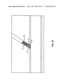 Method and system for sealing percutaneous punctures diagram and image