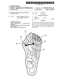 METHODS AND DEVICES FOR TREATING HALLUX VALGUS diagram and image