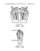 METHODS AND DEVICES FOR TREATING HALLUX VALGUS diagram and image