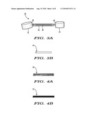 METHODS AND DEVICES FOR TREATING HALLUX VALGUS diagram and image