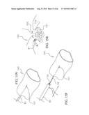 MEDICAL INSTRUMENT TO PLACE A PURSESTRING SUTURE, OPEN A HOLE AND PASS A GUIDEWIRE diagram and image