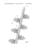 LOOP THROMBECTOMY DEVICE diagram and image