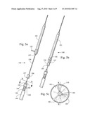 LOOP THROMBECTOMY DEVICE diagram and image