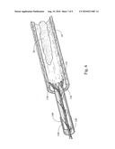 LOOP THROMBECTOMY DEVICE diagram and image