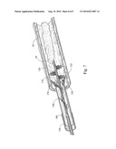 LOOP THROMBECTOMY DEVICE diagram and image