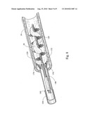 LOOP THROMBECTOMY DEVICE diagram and image