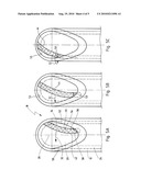 Medical Instrument For Cutting Tissue diagram and image