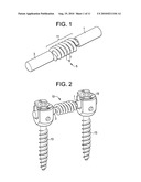 Dual Spring Posterior Dynamic Stabilization Device With Elongation Limiting Elastomers diagram and image