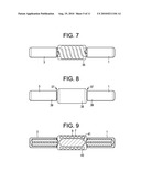 Dual Spring Posterior Dynamic Stabilization Device With Elongation Limiting Elastomers diagram and image