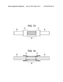 Dual Spring Posterior Dynamic Stabilization Device With Elongation Limiting Elastomers diagram and image