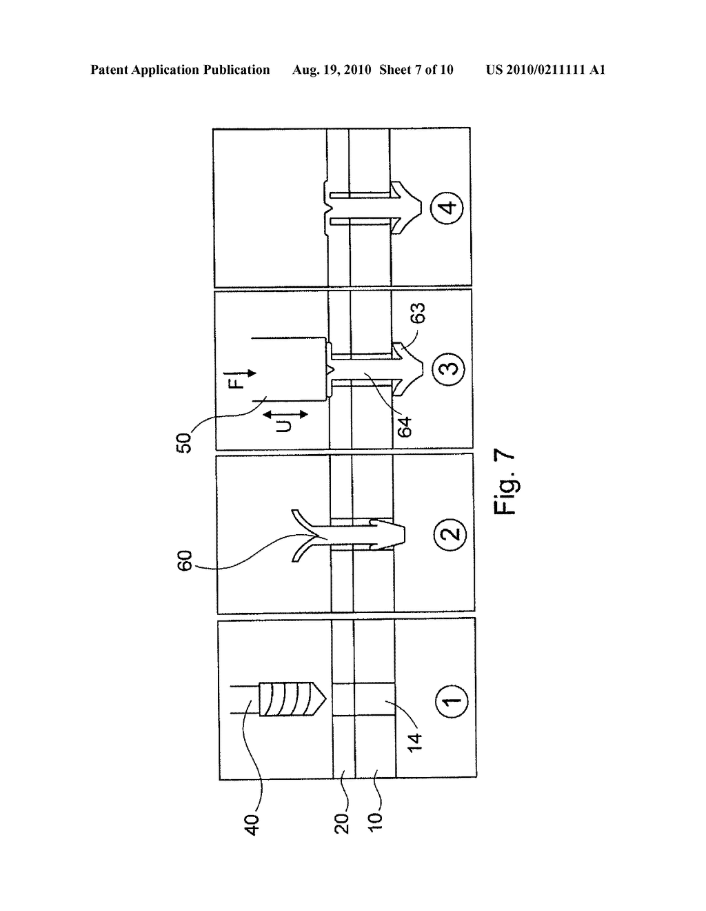 Angularly Stable Fixation Of An Implant - diagram, schematic, and image 08