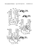 Polyaxial bone anchor with shelf capture connection diagram and image