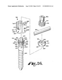 Polyaxial bone anchor with shelf capture connection diagram and image