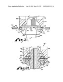 Polyaxial bone anchor with shelf capture connection diagram and image