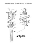 Polyaxial bone anchor with shelf capture connection diagram and image