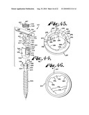 Polyaxial bone anchor with shelf capture connection diagram and image