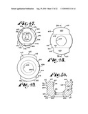 Polyaxial bone anchor with shelf capture connection diagram and image