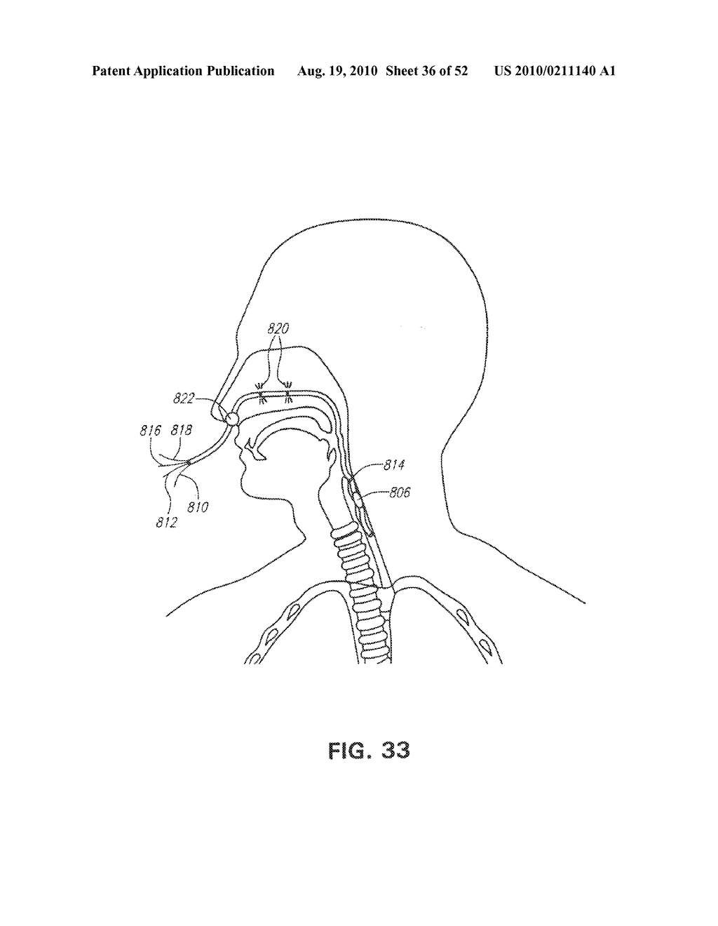 METHODS AND DEVICES FOR NON-INVASIVE CEREBRAL AND SYSTEMIC COOLING - diagram, schematic, and image 37