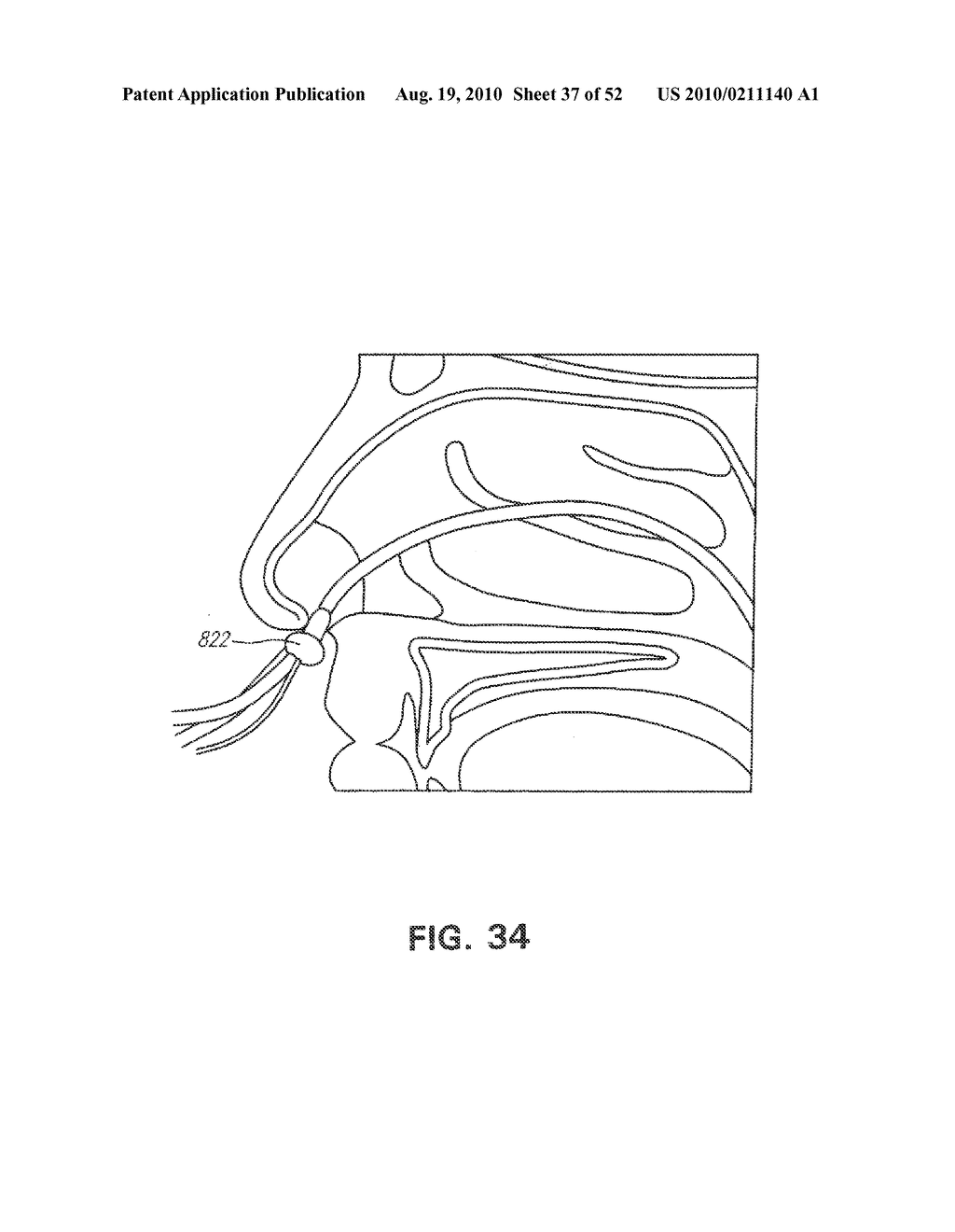 METHODS AND DEVICES FOR NON-INVASIVE CEREBRAL AND SYSTEMIC COOLING - diagram, schematic, and image 38