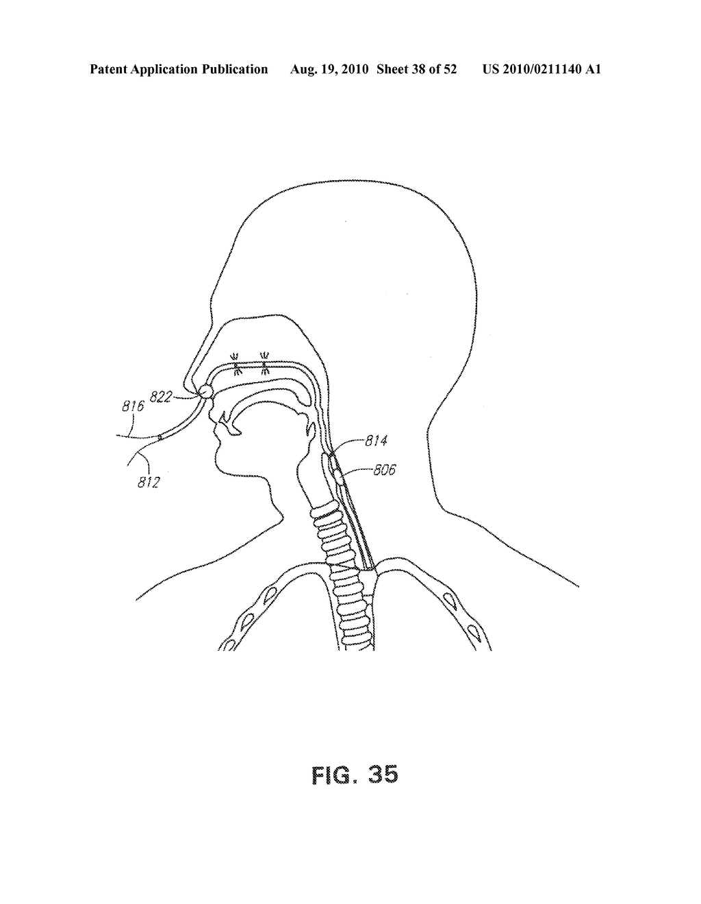 METHODS AND DEVICES FOR NON-INVASIVE CEREBRAL AND SYSTEMIC COOLING - diagram, schematic, and image 39