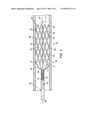 Retractable Drug Delivery System and Method diagram and image