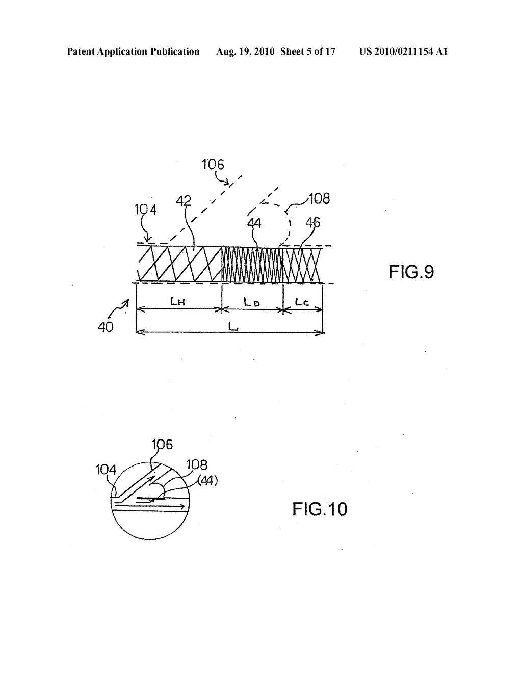 STENT, MICROCATHETER, BRAIDING APPARATUS FOR CONTINUOUS HOSELIKE BODY, AND PROCESS FOR MANUFACTURING STENT - diagram, schematic, and image 06