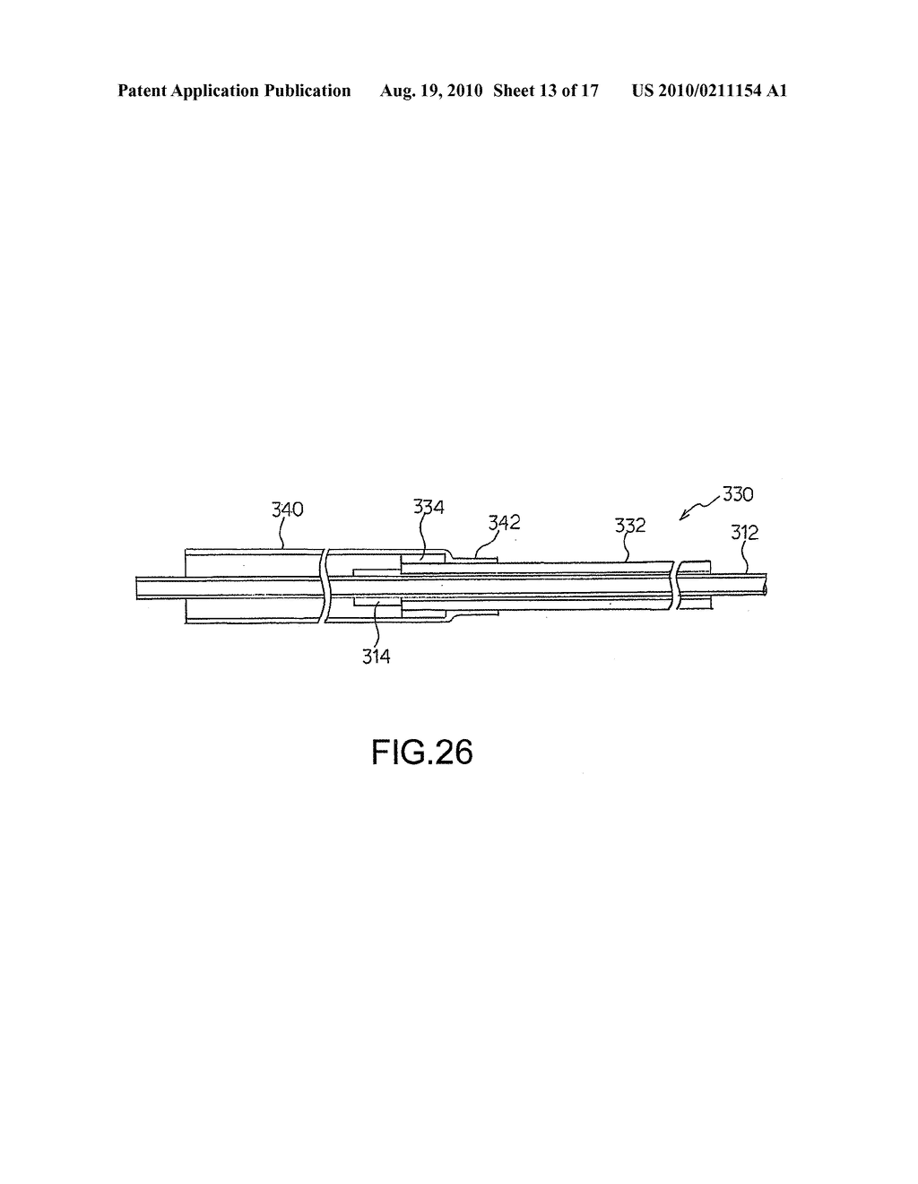 STENT, MICROCATHETER, BRAIDING APPARATUS FOR CONTINUOUS HOSELIKE BODY, AND PROCESS FOR MANUFACTURING STENT - diagram, schematic, and image 14