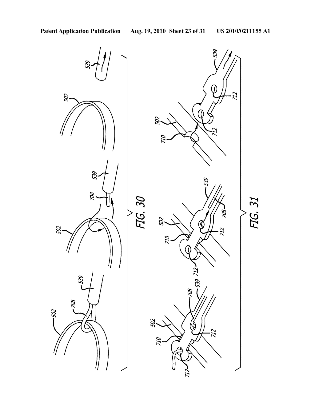 Electrical Conduction Block Implant Device - diagram, schematic, and image 24