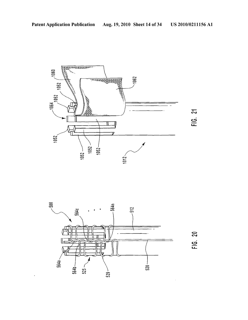 STENT DELIVERY DEVICE WITH EMBOLIC PROTECTION - diagram, schematic, and image 15