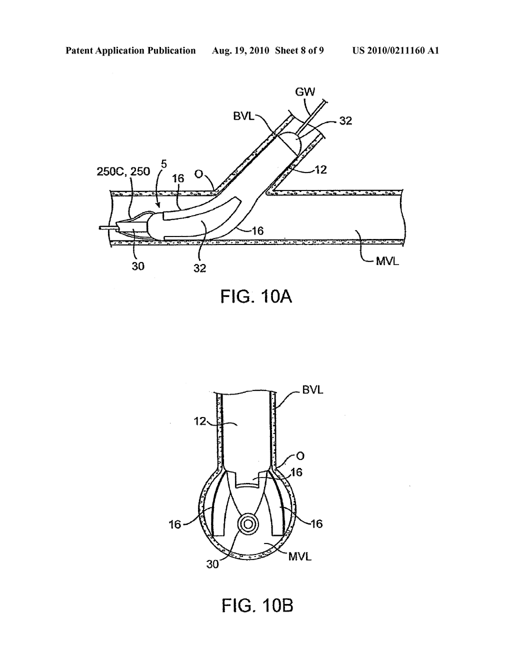 PROSTHESIS FOR PLACEMENT AT A LUMINAL OS - diagram, schematic, and image 09