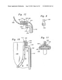 MINIMALLY-INVASIVE HEART VALVES diagram and image