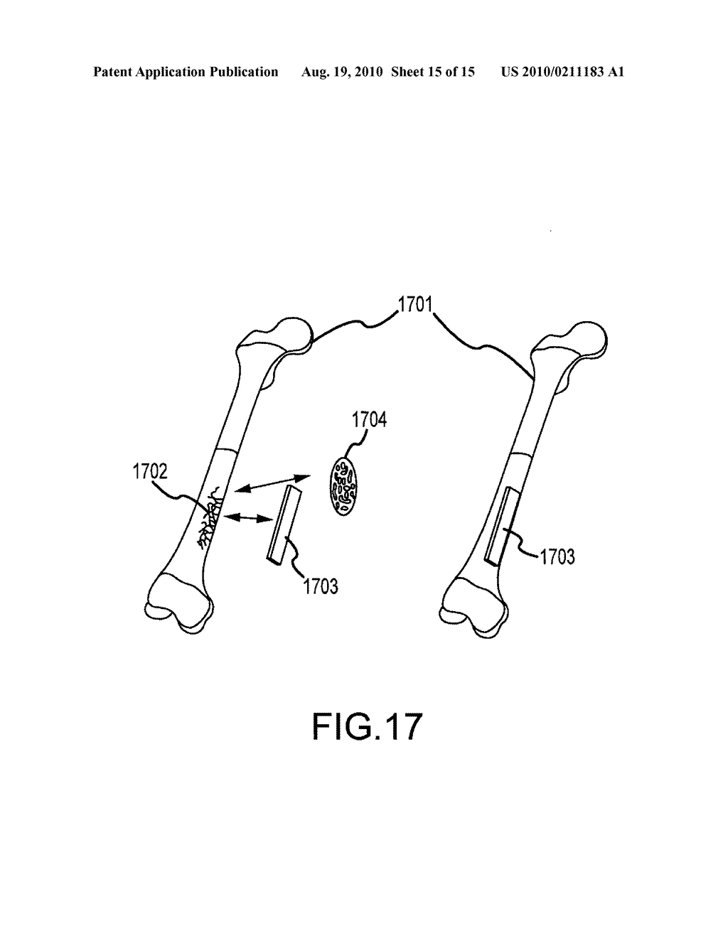 Chemical Mechanical Vapor Deposition Device for Production of Bone Substitute Material - diagram, schematic, and image 16