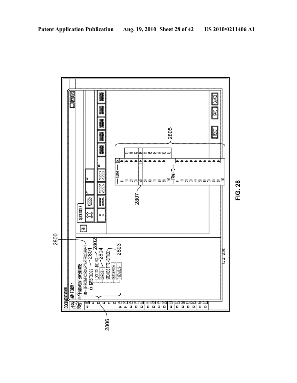 NATURALLY EXPRESSED MEDICAL PROCEDURE DESCRIPTIONS GENERATED VIA SYNCHRONIZED DIAGRAMS AND MENUS - diagram, schematic, and image 29