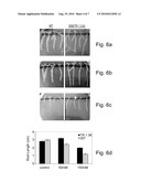 PLANTS OVER-EXPRESSING PME diagram and image