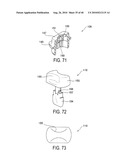 FASTENING ASSEMBLY FOR SECURING FLOOR MAT TO CARPET diagram and image