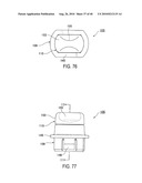 FASTENING ASSEMBLY FOR SECURING FLOOR MAT TO CARPET diagram and image