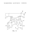 Method For Forming A Patient Specific Surgical Guide Mount diagram and image