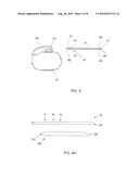 METHOD FOR MAKING SMOOTH TRANSITIONS BETWEEN DIFFERING LEAD SEGMENTS diagram and image