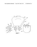 Hemorrhoid treatment device diagram and image